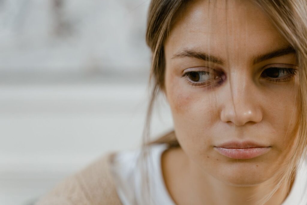 o-que-fazer-em-caso-de-violencia-domestica